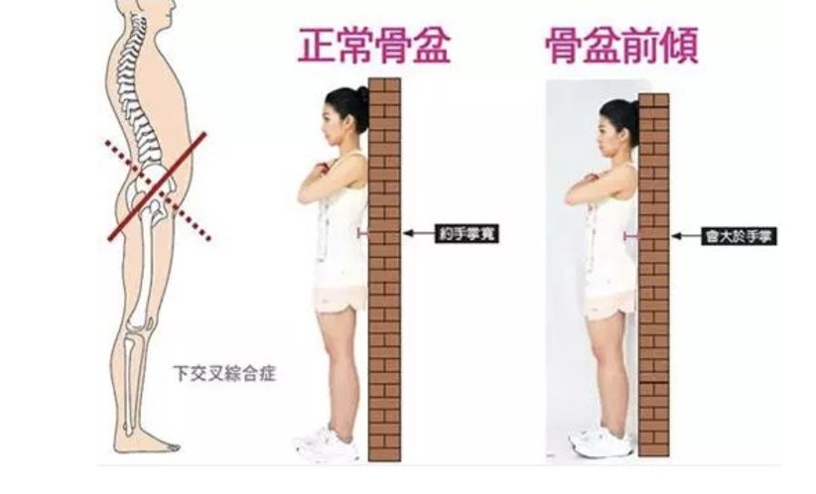 上班族「改善骨盆前倾」运动!零小腹好习惯,要当就当最美金秘书