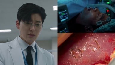 《Doctor X》肝臟刻字是真實事件！肝臟移植名醫在病人器官上簽名，竟辯稱「緩解壓力」