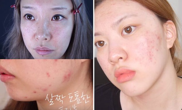 膚況不好5位YOUTUBER推薦！超神泛紅、粉刺、痘疤「遮瑕技巧」