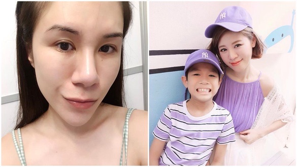去粉刺痘痘「救命水」推薦！鄉民默默大推好物拯救妳一生