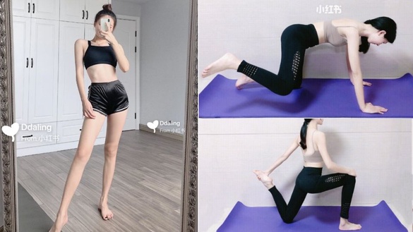 腿粗還分「脂肪型、水腫型」？不同腿搭配不同運動，1周速成腿精～