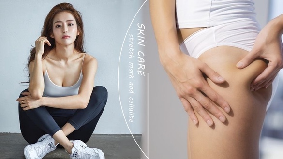 大腿肥胖紋、橘皮怎麼辦？皮膚科醫生：保濕是關鍵，加碼淡紋有感按摩+伸展運動！