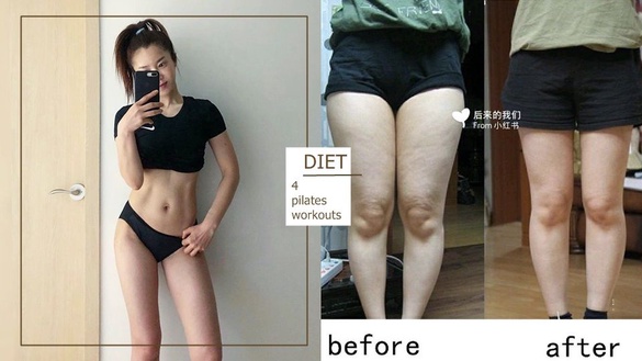 超有感瘦「大腿內側」只要4組皮拉提斯運動！三周大腿縫現身、穿褲不再有駱駝蹄！