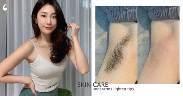 腋下黑黑超級糗？皮膚科醫生解析腋下黑原因，加碼腋下美白技巧推薦，腋下有感亮一階
