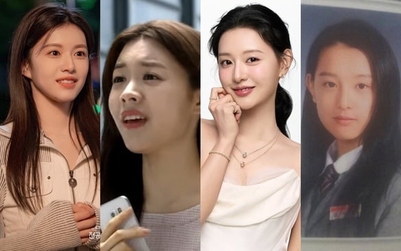 《機智住院醫生》高允貞陷整形爭議？韓劇10女星舊照，韓志旼宋慧喬沒變，IU現在美多了