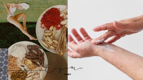 濕疹、汗皰疹怎麼辦？醫生親解：把握2大訣竅，換季不再發癢、紅腫