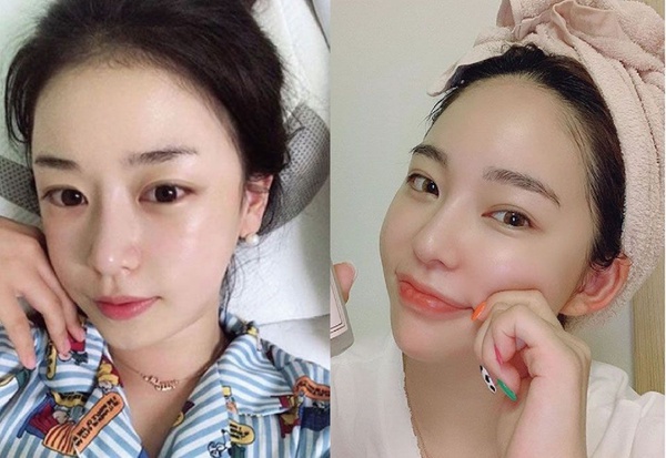 2019溫和「臉部去角質」推薦指南，讓你的素顏就自帶柔焦濾鏡，超透亮Q彈！