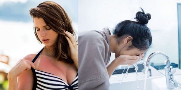 曬黑、曬紅，第一時間千萬別美白！拯救色差，把握曬後關鍵「美白修復黃金時間」就對了！