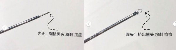 清粉刺必備工具解析！一次了解粉刺夾、粉刺針和粉刺棒差異，讓「開放性與閉鎖性粉刺」通通慢走不送～