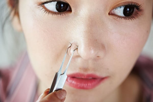清粉刺必備工具解析！一次了解粉刺夾、粉刺針和粉刺棒差異，讓「開放性與閉鎖性粉刺」通通慢走不送～