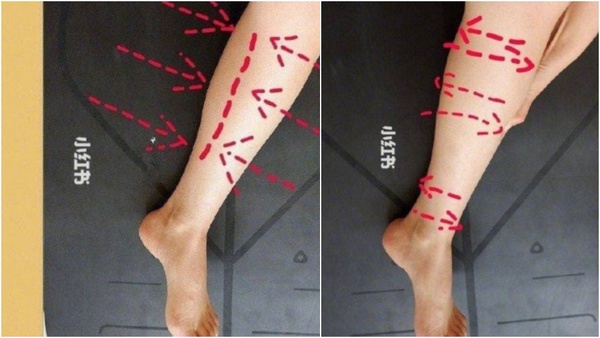 腿粗還分「脂肪型、水腫型」？不同腿搭配不同運動，1周速成腿精～