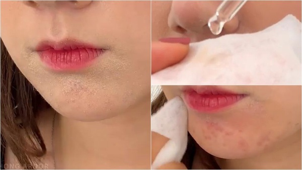 韓國彩妝師親授瑕疵皮「脫皮浮粉」急救法！補完妝超貼、超無瑕～再也不怕脫妝找上門！