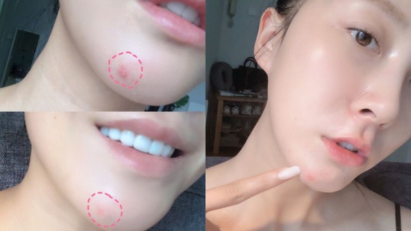 保養成分＆功效懶人包！美白、抗痘、酸類、修護、保濕，常見成分解析，看完秒懂廠商說什麼、不花冤枉錢！