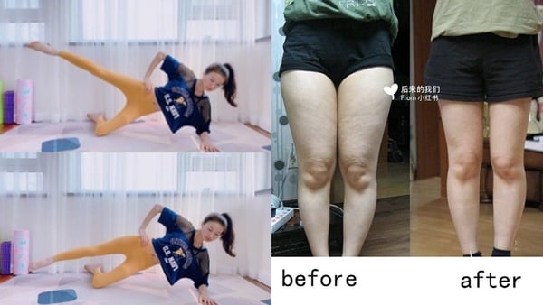 超有感瘦「大腿內側」只要4組皮拉提斯運動！三周大腿縫現身、穿褲不再有駱駝蹄！