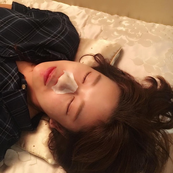 韓妞分享整形前必知重點！推薦整形、後悔項目詳細分析，加碼分享做完差異最大的整形部位
