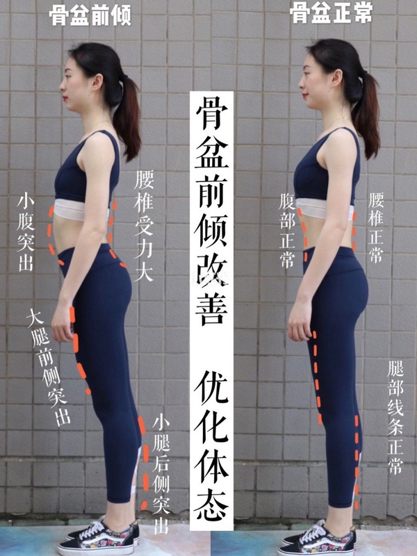 骨盆前傾讓小腹突出、小腿肌超壯？小紅書網美教練改善大腿、骨盆前傾動作，一個月練出細長腿