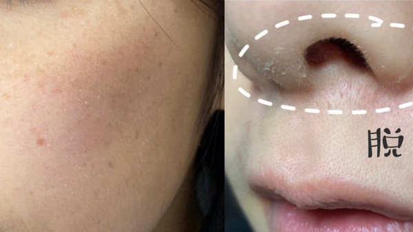 【底妝教學】韓系自然乾淨裸妝4技巧！脫皮、痘痘、毛孔都有解～底妝乾淨超遮不厚重！