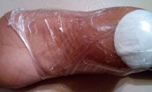 4步驟拋光「厚腳皮、龜裂腳跟」！保養技巧&自製高CP值足膜，快速變嬰兒的軟嫩腳！
