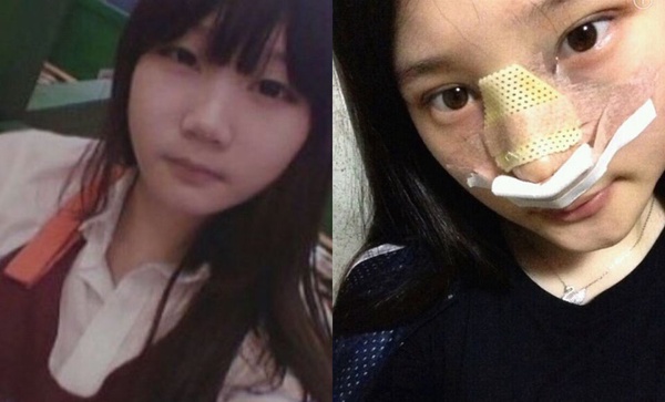 DIA鄭采妍也胖過！？醜小鴨變女神，三個月減去16公斤的超勵志減肥菜單大公開！