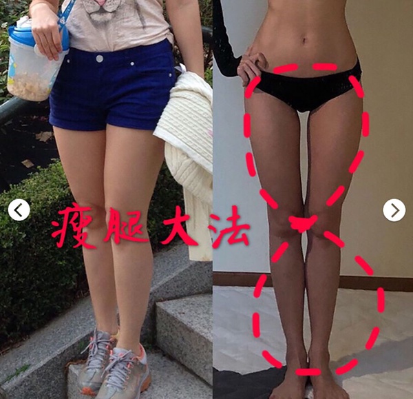 「大腿根部」5招簡單運動就能瘦！肉不再摩擦，穿比基尼三角褲更性感