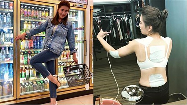 剷肉25公斤零肥胖紋的3大關鍵！網推去除肥胖紋的神油、乳霜是這些