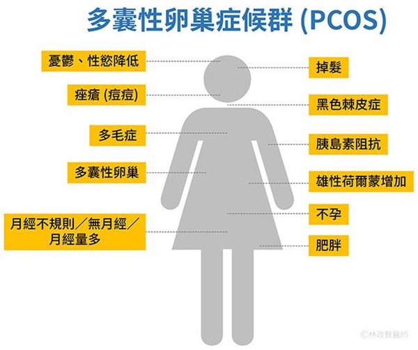 內分泌失調，等於天天爆生理痘！25歲後痘痘仍爆長，快檢查是不是「婦科痘」！