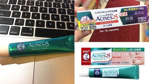 內分泌失調，等於天天爆生理痘！25歲後痘痘仍爆長，快檢查是不是「婦科痘」！