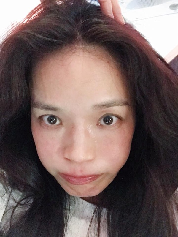 雀斑如何消除？5必知雀斑成因，醫美與日常保養差異全公開！