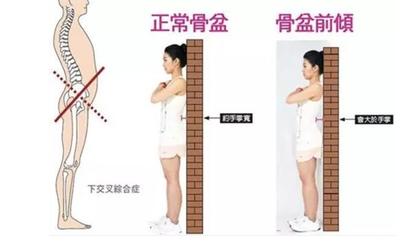 上班族「改善骨盆前傾」運動！零小腹好習慣，要當就當最美金秘書