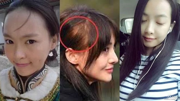 禿髮女孩必學「髮量激增6招」，髮際線前進，豐厚秀髮更好造型！