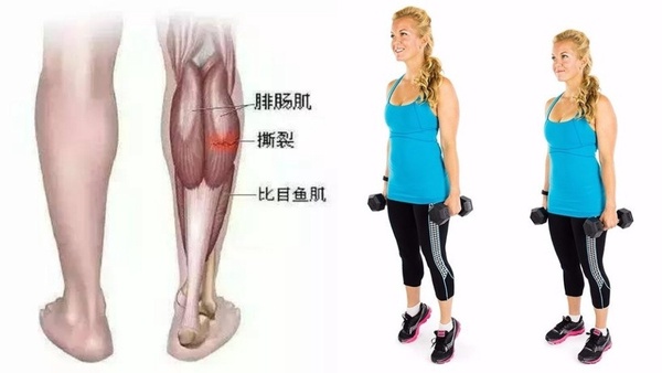 教練6招「提臀瘦小腿」居家訓練!一週做兩次,速甩粗壯蘿蔔腿,變身楊冪同款筷子腿!