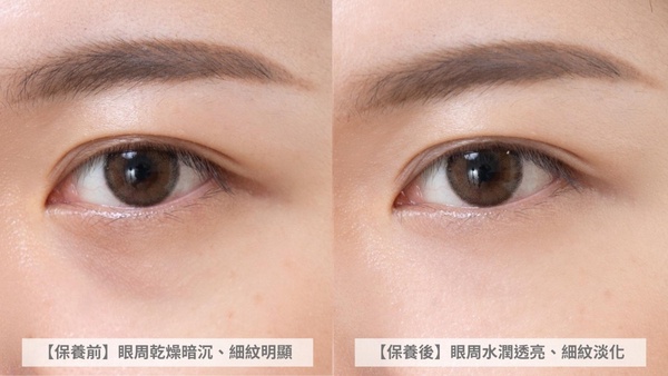 藍熨斗眼霜 ACE撫紋眼霜 ACE博士A醇精華 A醇眼霜推薦 DrMay 美博士