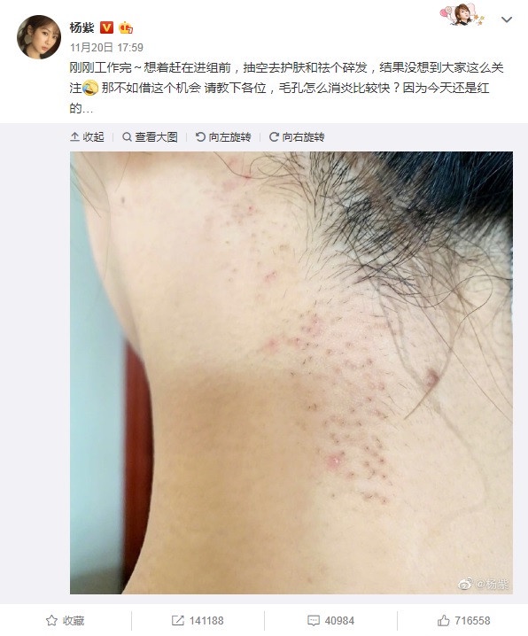 楊紫被曝現身整形醫院！楊紫出道17年進化史，臉長一樣，只是造型有點嚇人