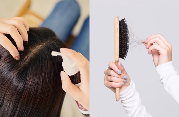 換季頭皮狂冒痘？頭皮痘痘成因及解決方法，掉髮嚴重、毛囊炎舒緩有感