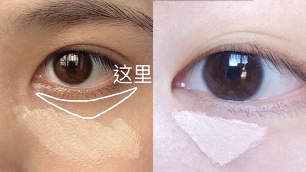 黑眼圈跟淚溝怎麼分?