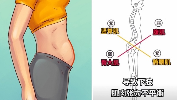 改善骨盆前傾也能瘦肚子！從「肚子形狀」找出肥胖原因，對症下藥減小腹、速成小腰精！