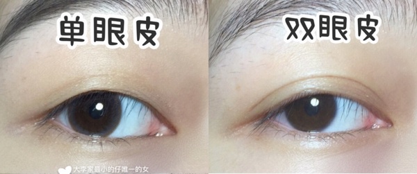 單眼皮有救了！小紅書爆紅「雙眼皮肌肉按摩」3招天天按、網友實測一個月擁有雙眼皮！