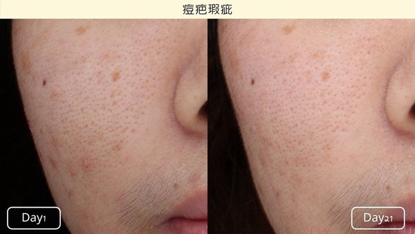 美白精華推薦：Kiehl's 契爾氏 激光極淨白淡斑精華 30/50ml，NT.2400/3200