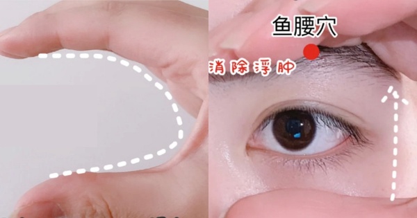 「眼皮下垂」老10歲！美容師親授「內雙變外雙」眼周按摩法，拯救腫泡內雙、眼皮鬆弛
