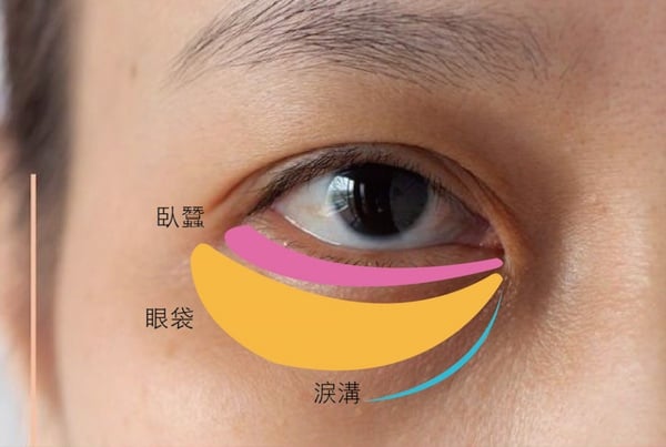 眼袋淚溝能消除！保養老師按摩3技巧消除眼袋淚溝，免手術細紋、浮腫都消滅！