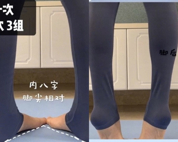 小腿粗壯分3大類！健身教練不同腿型「瘦小腿運動」，做對小腿外翻、小腿肌立消