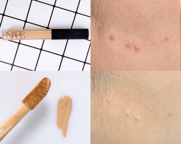 「痘疤痘印/黑眼圈」遮瑕膏合集！6款熱門遮瑕膏評比推薦，一抹p掉瑕疵、清爽不卡粉