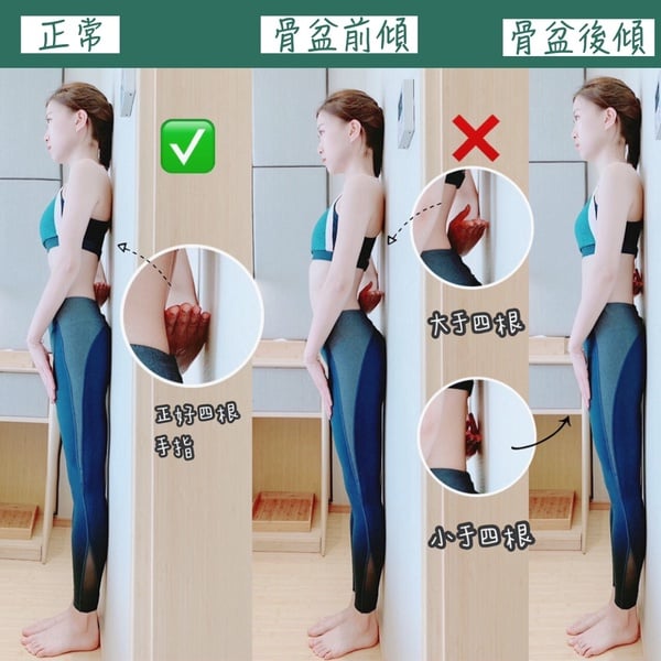 骨盆後傾、大腿前側突出自我檢測!四個動作矯正骨盆歪斜,解決膝超伸、屁股塌陷有感
