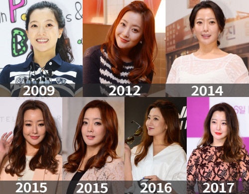 《Alice愛麗絲》金喜善自我管理超嚴格！42歲凍齡美貌這樣來的