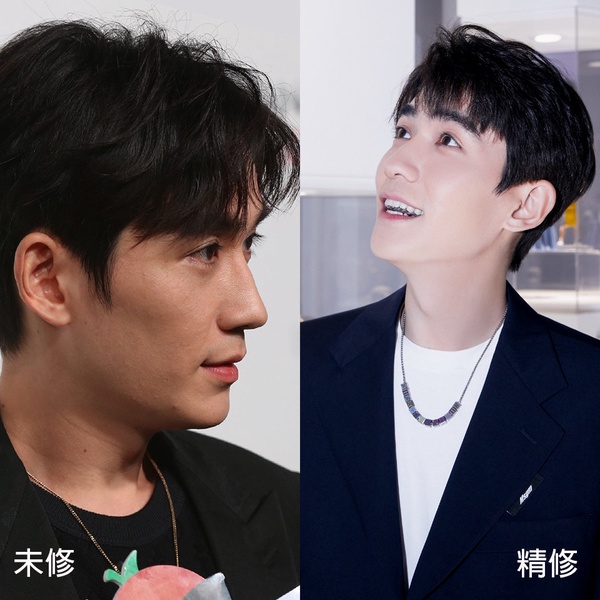 宋威龍皮膚狀態嚇死人！10位陸劇男星「未修生圖」，李現皮膚好滑，王一博長痘痘像淚痣