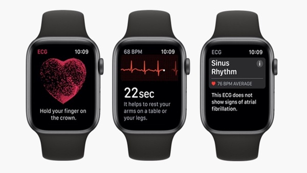 終於解鎖!台灣將正式開放 Apple Watch 心電圖功能,支援Apple Watch S4 後續機型!