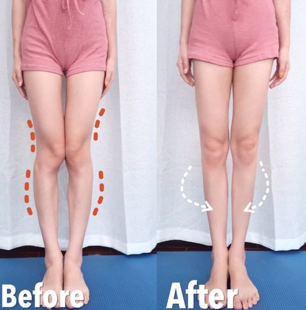 小腿外翻、XO型腿比小腿肌肉更顯胖！4動作改善小腿肌肉外翻，2週有感瘦腿、腿直又細