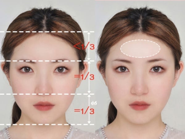 露額頭髮型、稀疏髮必看!不同臉型「額頭修容」技巧,拯救高額頭、大腦門、偽禿感