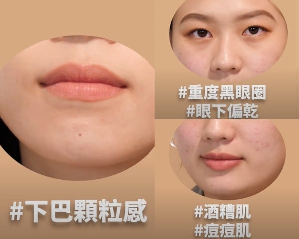 【編輯真心話】7款熱門「專櫃遮瑕膏」評比推薦！黑眼圈/痘印痘疤用哪支，跟著買不踩雷