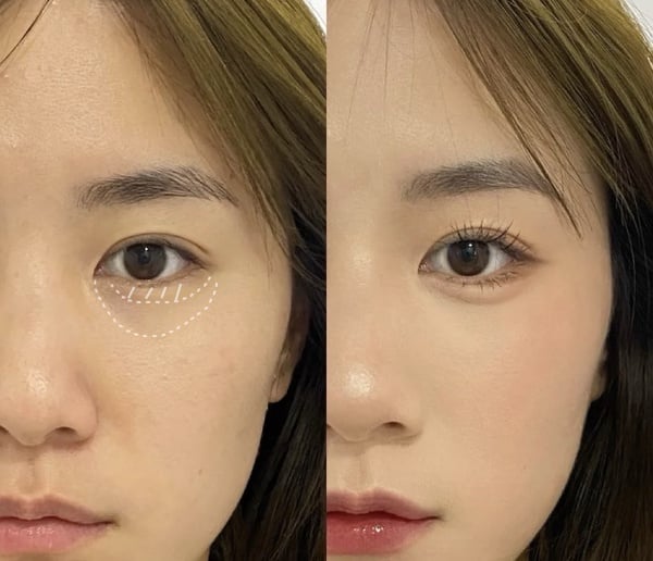 新手超實用「淚溝遮瑕教學」！完美隱形眼袋淚溝，米色眼影定妝、保留臥蠶是關鍵